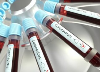 COVID-19 México: Van 20 muertos y 993 casos confirmados